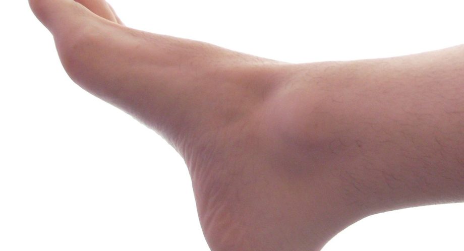Flash : l’homme con comme ses pieds était en réalité un pied